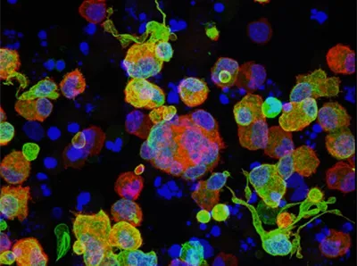 Image of in vitro differentiated megakaryoblastic cells stained for CD41 (red), TUBB1 (green), and DNA (blue)