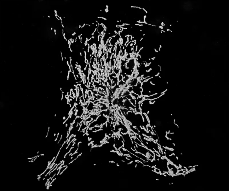 decorative image of mitochondria in axons