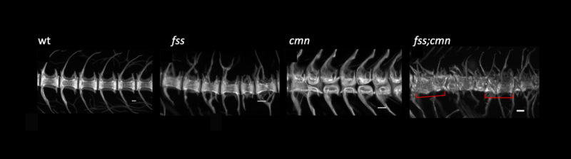 x-ray comparing four different spines.