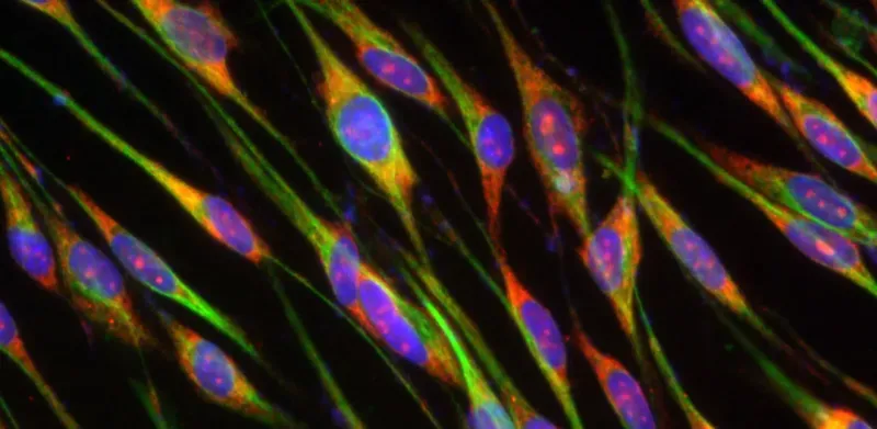 microscopic strands that look like peacock feathers.