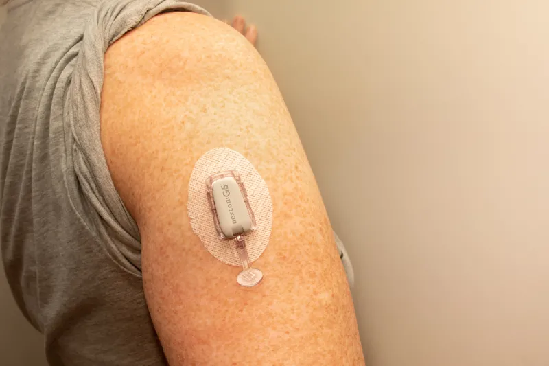 A close up image of an arm with a rolled up grey sleeve to show off their diabetes patch.