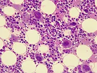 bone marrow cells