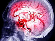 skull xray showing brain and blood vessels