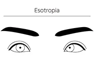 drawing of a pair of eyes with one crossed