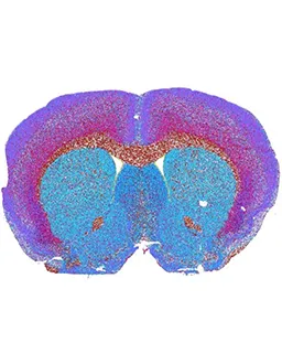 purple, red, orange, and blue brain scan