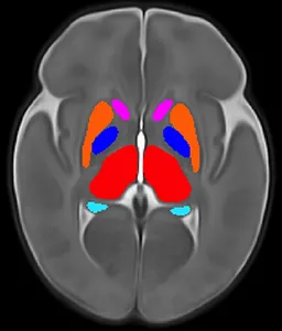 grey brain with center parts in pink, orange, blue, red, and teal