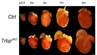 Images of a heart in different stages of growth.