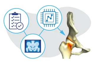 three circles with a checklist, pelvic xray and chart pointing to a bone joint