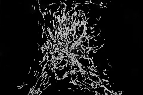 decorative image of mitochondria in axons