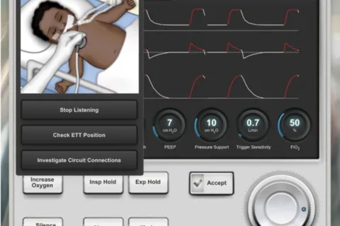 medical ventilator simulator with baby wearing ventilator